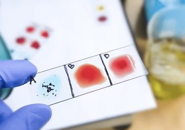 Golongan Darah Ini Berisiko Tinggi Kena Stroke di Usia Muda