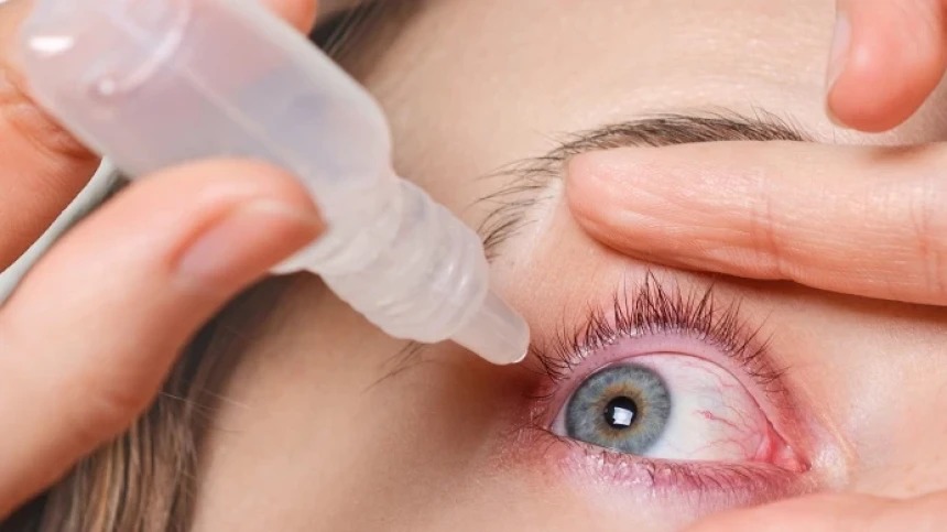 Mata Perih Akibat Kabut Asap, Bolehkah Langsung Pakai Obat Tetes Mata?