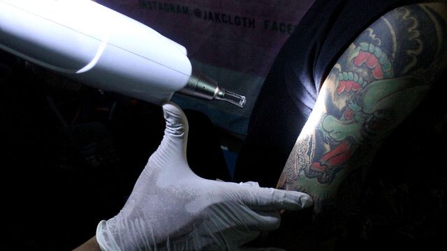 Tato Salib di Tubuh Pria Ini Mendadak Hilang, Ternyata Idap Kondisi Medis Langka