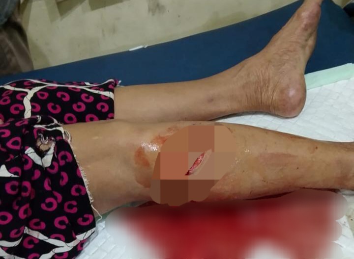 DPKP Inhil Pastikan Pelaku Serangan Hanya Satu Ekor Monyet, 16 Warga Jadi Korban Cakaran dan Gigitan