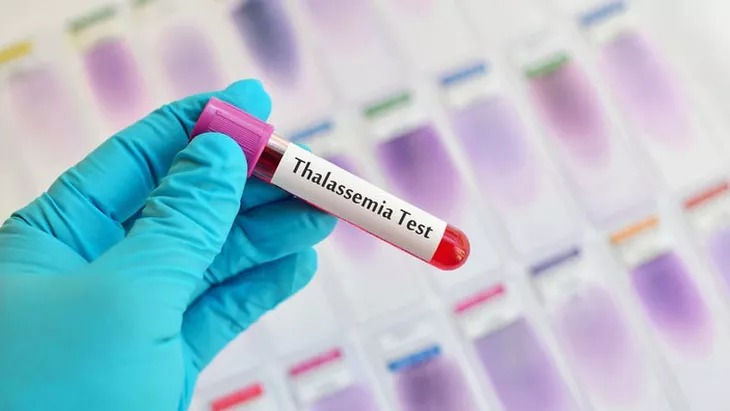 Mengenal Thalasemia, Penyakit Genetik yang Bisa Diturunkan dari Orang Tua