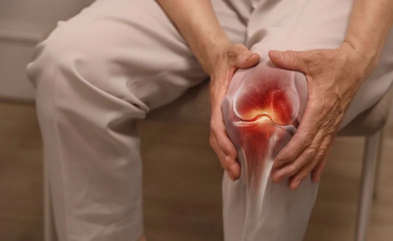 Pernah Dengar Bunyi 'Krek' di Lutut Saat Berdiri? Dokter Ungkap Penyebabnya