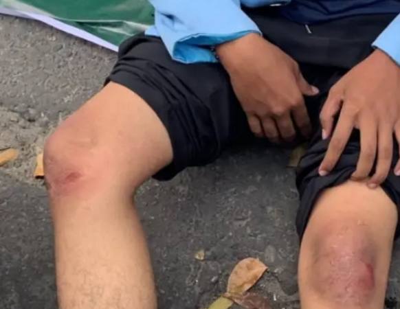 Lima Orang Mahasiswa Alami Cedera Akibat Aksi Saling Dorong di Kantor Gubernur