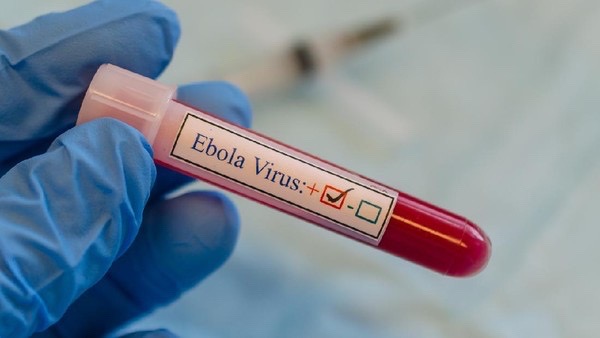Ebola Jadi Darurat Global, Kemenkes Imbau Hindari Makanan Jenis Ini