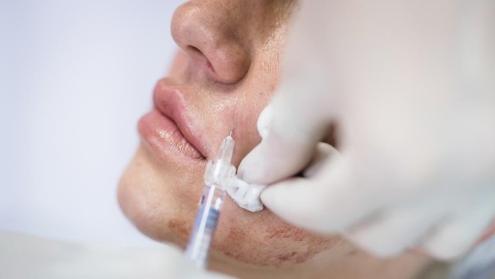 Viral di Sosmed, Skin Booster Kolagen Korsel Ini Pakai Jaringan Kuliat Mayat