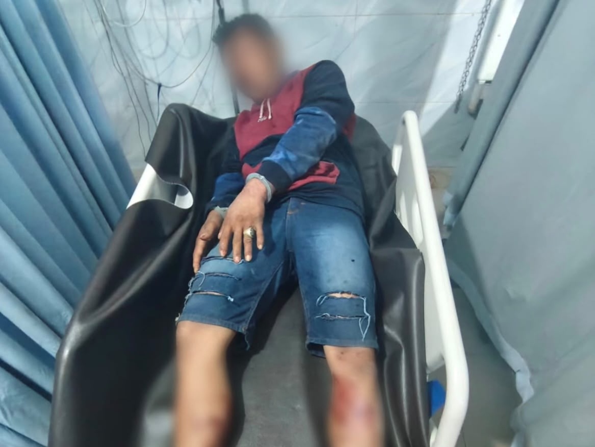 Serang Pakai Sajam Saat Disergap, Polisi Tembak Pengedar Ekstasi di Pekanbaru