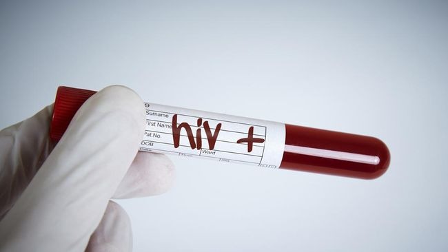 Viral Ratusan Anak di Sidoarjo Terpapar HIV, Kemenkes Buka Data Resmi