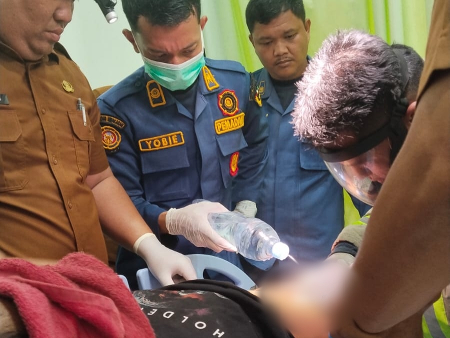 Cincin Nyangkut di Kemaluan, Pria di Pekanbaru Minta Bantuan Damkar